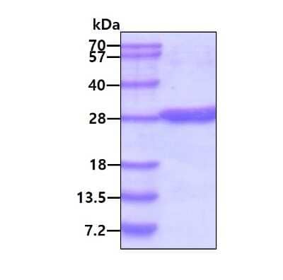 SDS-PAGE Recombinant Human NT5M His Protein